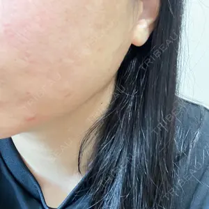 MIO CLINIC 梅田院口コミ