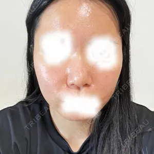 MIO CLINIC 梅田院口コミ