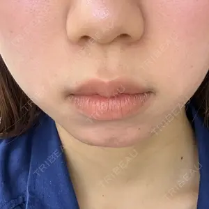 フィラークリニック フィラークリニック 名古屋栄院口コミ