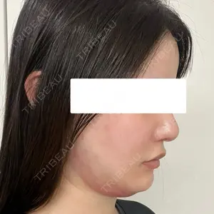 藤・ナチュレ美容クリニック 藤・ナチュレ美容クリニック 銀座院口コミ