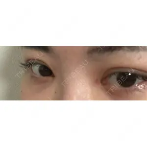 口コミ