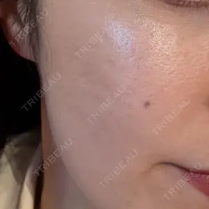 東京シルククリニック 東京シルククリニック 東京神田院口コミ