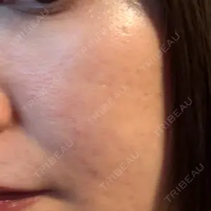 東京シルククリニック 東京シルククリニック 東京神田院口コミ