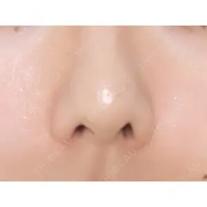 東京素肌クリニックの口コミ
