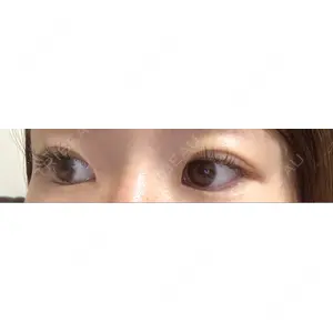 口コミ