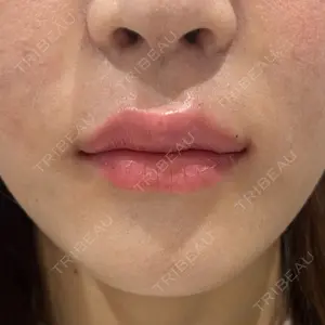 口コミ
