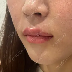 口コミ