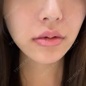 DMTC CLINIC DMTC美容皮膚科 大宮院口コミ