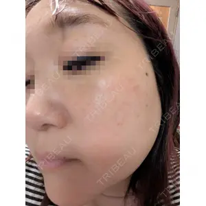 ルラ美容クリニック ルラ美容クリニック 静岡院口コミ
