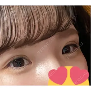 口コミ