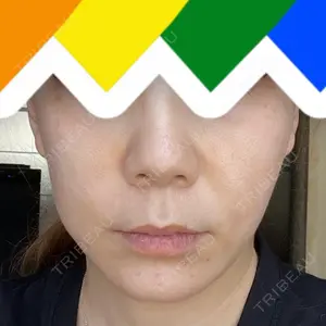 A CLINIC（エークリニック） A CLINIC（エークリニック） 銀座院口コミ