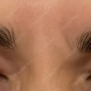 TCB東京中央美容外科 TCB東京中央美容外科 名古屋栄院口コミ