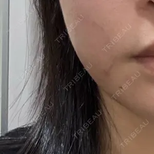 PureMe Skin Clinic（ピュアミースキンクリニック麻布）口コミ