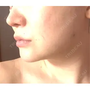 L‘amour clinic Tokyo【ラムールクリニック東京】口コミ