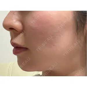 TCB東京中央美容外科 TCB東京中央美容外科 銀座有楽町院口コミ