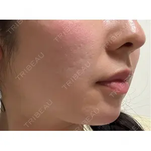 TCB東京中央美容外科 TCB東京中央美容外科 銀座有楽町院口コミ