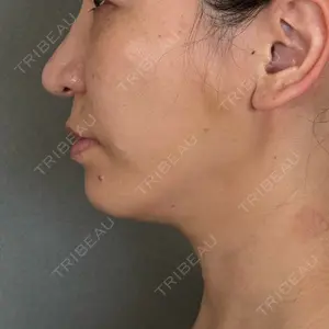 アリエル美容クリニック アリエル美容クリニック 大宮院口コミ
