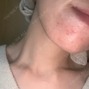 RAISE CLINIC 【レイズクリニック】口コミ