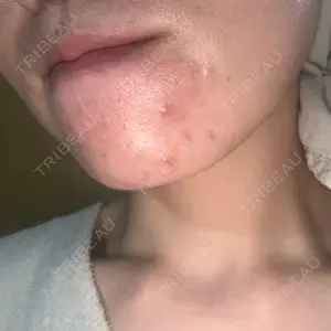 RAISE CLINIC 【レイズクリニック】口コミ