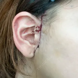 A CLINIC（エークリニック） A CLINIC（エークリニック） 銀座院口コミ