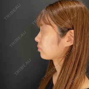 HAAB×DREAM BEAUTY CLINIC HAAB×DREAM BEAUTY CLINIC 大阪梅田院口コミ