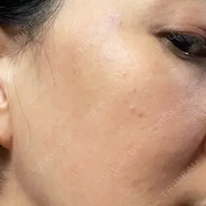 ルラ美容クリニック ルラ美容クリニック 静岡院口コミ