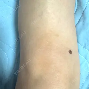下北沢スキンクリニックの口コミ