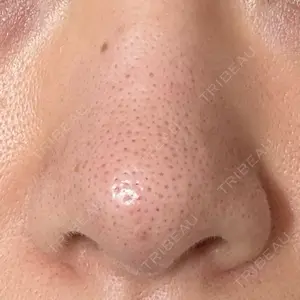 日本美容・医療クリニック 日本美容・医療クリニック 六本木院口コミ