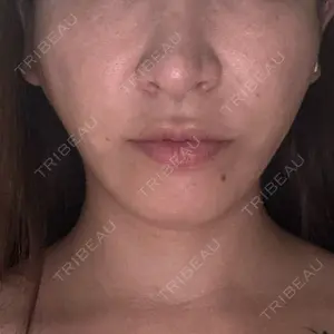 アリエル美容クリニック アリエル美容クリニック 大宮院口コミ