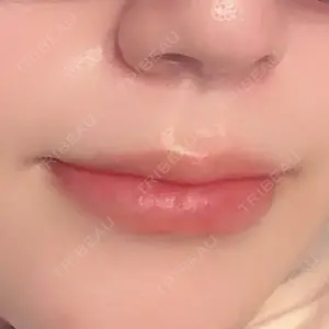口コミ