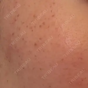 ルラ美容クリニック ルラ美容クリニック 大宮院 / ルラスキンクリニック 大宮院口コミ