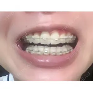 口コミ