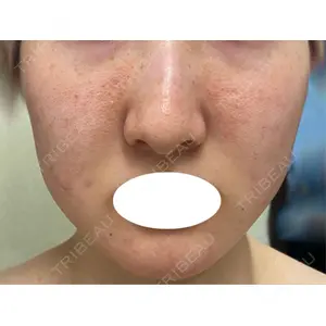 東京シルククリニック 東京シルククリニック 東京神田院口コミ