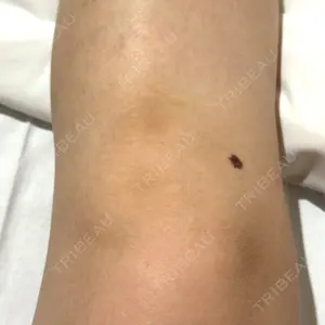 下北沢スキンクリニックの口コミ