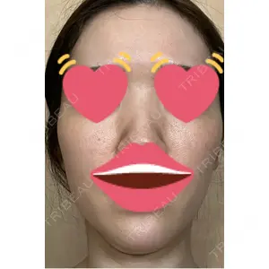 メディカルエピレーションクリニック メディカルエピレーションクリニック 心斎橋院口コミ