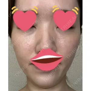 メディカルエピレーションクリニック メディカルエピレーションクリニック 心斎橋院口コミ