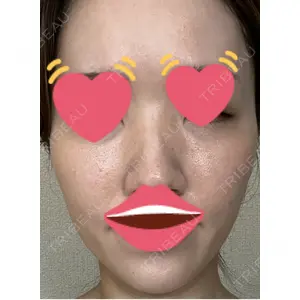 メディカルエピレーションクリニック メディカルエピレーションクリニック 心斎橋院口コミ