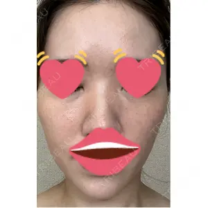 メディカルエピレーションクリニック メディカルエピレーションクリニック 心斎橋院口コミ