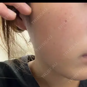 ルラ美容クリニック ルラ美容クリニック 池袋院口コミ