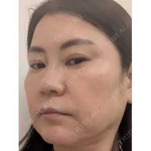 TCB東京中央美容外科 TCB東京中央美容外科 松山院口コミ