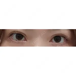 口コミ