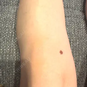 下北沢スキンクリニックの口コミ