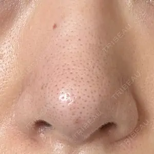 日本美容・医療クリニック 日本美容・医療クリニック 六本木院口コミ