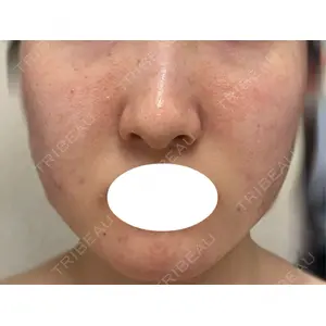 東京シルククリニック 東京シルククリニック 東京神田院口コミ