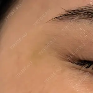 TCB東京中央美容外科 TCB東京中央美容外科 名古屋栄院口コミ