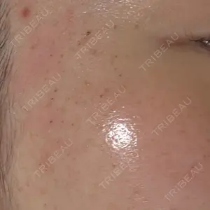 ルラ美容クリニック ルラ美容クリニック 大宮院 / ルラスキンクリニック 大宮院口コミ