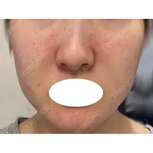 東京シルククリニック 東京シルククリニック 東京神田院口コミ