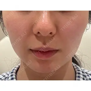 TCB東京中央美容外科 TCB東京中央美容外科 銀座有楽町院口コミ