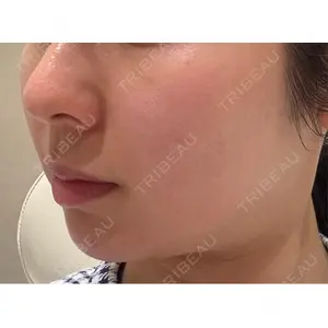 TCB東京中央美容外科 TCB東京中央美容外科 銀座有楽町院口コミ