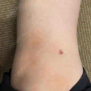 下北沢スキンクリニックの口コミ